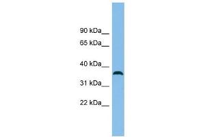 C18orf25 antibody used at 1 ug/ml to detect target protein. (C18ORF25 antibody  (N-Term))