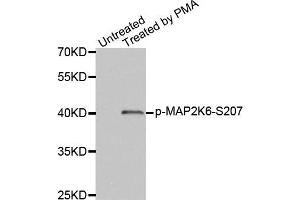 Western Blotting (WB) image for anti-Mitogen-Activated Protein Kinase Kinase 6 (MAP2K6) (pSer207) antibody (ABIN1870360) (MAP2K6 antibody  (pSer207))