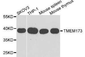 Western blot analysis of extracts of various cell line, using TMEM173 antibody. (STING/TMEM173 antibody  (AA 170-379))
