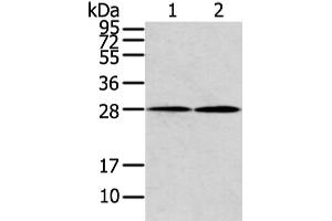 Western Blotting (WB) image for anti-Potassium Large Conductance Calcium-Activated Channel, Subfamily M, beta Member 1 (KCNMB1) antibody (ABIN5958468) (KCNMB1 antibody)