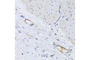 Immunohistochemistry of paraffin-embedded human colon using PECAM1 antibody. (CD31 antibody)