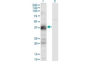 Western Blot analysis of EDNRA expression in transfected 293T cell line by EDNRA monoclonal antibody (M02), clone 2A5. (Endothelin-1 Receptor antibody  (AA 18-80))