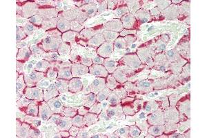Human Liver: Formalin-Fixed, Paraffin-Embedded (FFPE) (E-cadherin antibody)