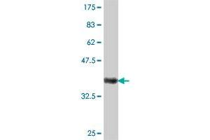 Western Blot detection against Immunogen (36. (CROT antibody  (AA 2-99))