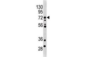 MELK antibody used in western blot to detect MRLK/MELK in mouse brain tissue lysate. (MELK antibody  (AA 201-230))