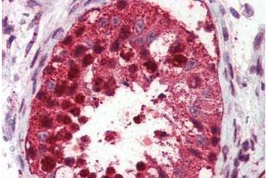 Testis, Human: Formalin-Fixed, Paraffin-Embedded (FFPE) (USP2 antibody  (C-Term))