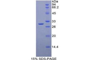 SDS-PAGE analysis of Human GSTm2 Protein. (GSTM2 Protein)