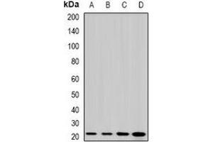 Western blot analysis of MP19 expression in HepG2 (A), Jurkat (B), mouse eye (C), rat liver (D) whole cell lysates. (LIM2 antibody)