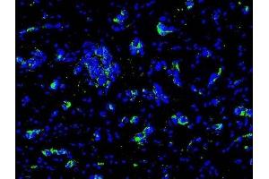 Immunofluorescence (IF) image for anti-Fms-Related tyrosine Kinase 1 (VEGFR1) (FLT1) (AA 1162-1260) antibody (ABIN725795)