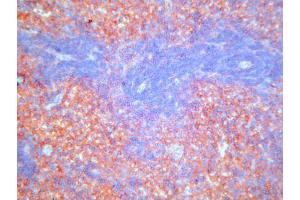 Immunohistochemistry (IHC) image for anti-Complement Component (3b/4b) Receptor 1-Like (CR1L) antibody (ABIN781721) (CR1L antibody)