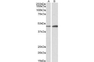 Western Blotting (WB) image for anti-NDRG Family Member 2 (NDRG2) antibody (ABIN5872346) (NDRG2 antibody)