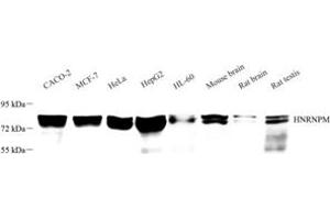 Western blot analysis of HNRNPM (ABIN7074247) at dilution of 1: 3000 (HnRNP M1-M4 抗体)