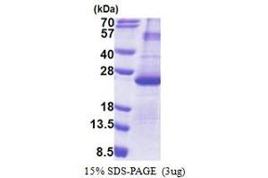 SDS-PAGE (SDS) image for Dual Specificity Phosphatase 26 (DUSP26) (AA 1-211) protein (His tag) (ABIN5853235) (DUSP26 Protein (AA 1-211) (His tag))