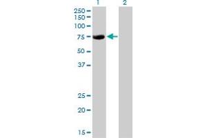 Western Blotting (WB) image for anti-Core-binding Factor, Runt Domain, alpha Subunit 2, Translocated To, 2 (CBFA2T2) (AA 201-304) antibody (ABIN599484) (CBFA2T2 antibody  (AA 201-304))