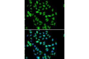 Immunofluorescence analysis of U2OS cells using STAMBP antibody. (STAMBP antibody)