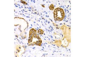 Immunohistochemistry of paraffin-embedded human kidney using KRT15 antibody. (KRT15 antibody)