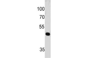 Western blot testing of human HeLa cell lysate with PAX7 antibody (clone PAX7/497). (PAX7 antibody  (AA 301-505))