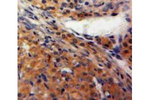 Used in DAB staining on fromalin fixed paraffin-embedded Ovary tissue (FBLN2 antibody  (AA 858-1069))