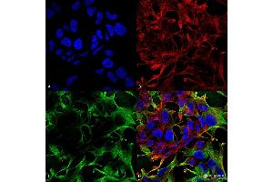 Immunocytochemistry/Immunofluorescence analysis using Mouse Anti-Neuroligin 3 Monoclonal Antibody, Clone S110-29 . (Neuroligin 3 antibody  (AA 730-848) (PerCP))