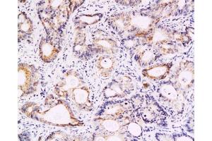 Immunohistochemistry (Paraffin-embedded Sections) (IHC (p)) image for anti-Baculoviral IAP Repeat-Containing 5 (BIRC5) (AA 85-142) antibody (ABIN670911)