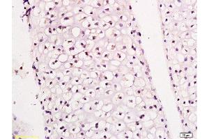 Formalin-fixed and paraffin embedded rat articular cartilage tissue labeled with Anti-CK14 Polyclonal Antibody, Unconjugated at 1:300 followed by conjugation to the secondary antibody and DAB staining (pan Keratin antibody)