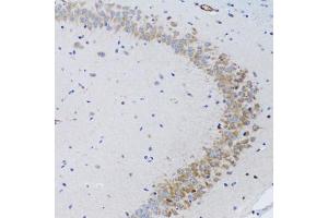 Immunohistochemistry of paraffin-embedded rat brain using TNFSF12 Antibody (ABIN1876860) at dilution of 1:100 (20x lens). (TWEAK antibody)