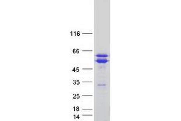 TACC1 Protein (Transcript Variant 2) (Myc-DYKDDDDK Tag)