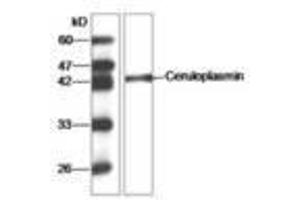 Image no. 1 for anti-Ceruloplasmin (Ferroxidase) (CP) (AA 933-1065) antibody (ABIN791453) (Ceruloplasmin antibody  (AA 933-1065))