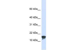 TMEM166 antibody used at 1 ug/ml to detect target protein. (TMEM166 antibody  (N-Term))