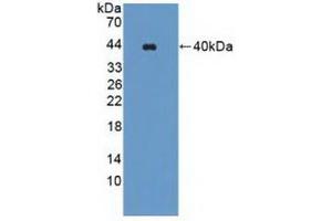 Detection of Recombinant WNK1, Human using Polyclonal Antibody to WNK Lysine Deficient Protein Kinase 1 (WNK1) (WNK1 antibody  (AA 1954-2231))