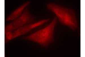Immunofluorescence staining of methanol-fixed Hela cells using Phospho-G3BP1-S232 antibody. (G3BP1 antibody  (pSer232))