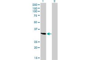 Western Blot analysis of SPARC expression in transfected 293T cell line by SPARC monoclonal antibody (M02A), clone 1B2. (SPARC antibody  (AA 1-303))