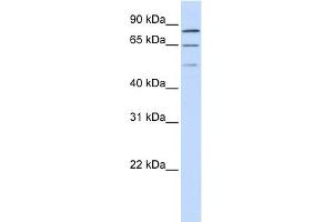 WB Suggested Anti-ZNF699 Antibody Titration:  0. (ZNF699 antibody  (N-Term))