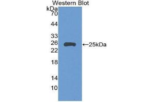 Western Blotting (WB) image for anti-Fibulin 2 (FBLN2) (AA 896-1106) antibody (ABIN1858812) (FBLN2 antibody  (AA 896-1106))