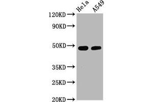 Western Blot Positive WB detected in Hela whole cell lysate,A549 whole cell lysate All lanes Phospho-GATA3 antibody at 2. (Recombinant GATA3 antibody  (pSer308))