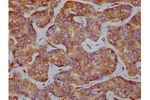 Immunohistochemistry (IHC) image for anti-Eukaryotic Translation Initiation Factor 2 Subunit 1 (EIF2S1) (pSer51) antibody (ABIN7127690)