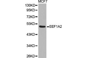 Western blot analysis of extracts of MCF-7 cells, using EEF1A2 antibody. (EEF1A2 antibody)