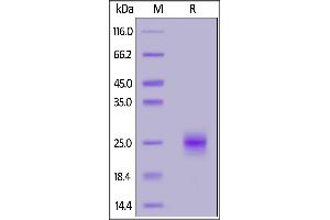 Biotinylated Human GITR, His,Avitag™ on  under reducing (R) condition. (TNFRSF18 Protein (AA 26-161) (His tag,AVI tag,Biotin))