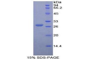 SDS-PAGE (SDS) image for Angiopoietin 1 (ANGPT1) (AA 266-497) protein (His tag) (ABIN1078786) (Angiopoietin 1 Protein (ANGPT1) (AA 266-497) (His tag))