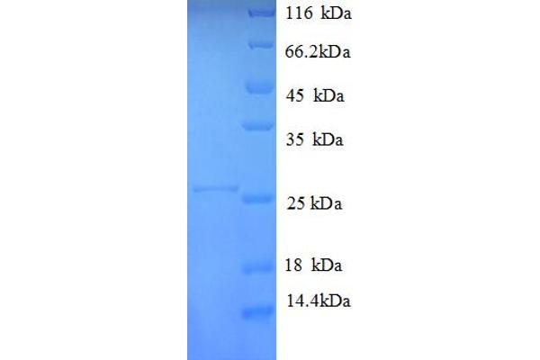 HLA-DPA1 Protein (AA 29-222, Extracellular) (His tag)