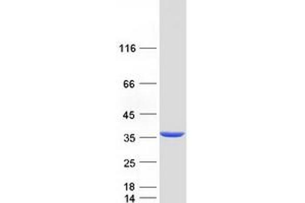 DECR1 Protein (Myc-DYKDDDDK Tag)