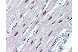 SOX4 antibody was used for immunohistochemistry at a concentration of 4-8 ug/ml. (SOX4 antibody  (N-Term))