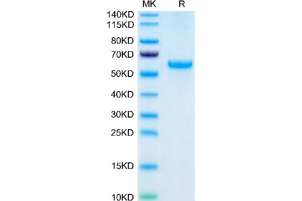 ADIPOQ Protein (AA 19-244) (Fc Tag)