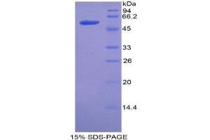 SDS-PAGE (SDS) image for Angiotensin I Converting Enzyme (Peptidyl-Dipeptidase A) 1 (ACE) (AA 504-597) protein (His tag,MBP tag) (ABIN1879041) (Angiotensin I Converting Enzyme 1 Protein (AA 504-597) (His tag,MBP tag))