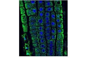 Immunofluorescence (IF) image for anti-Heat Shock 70kDa Protein 5 (Glucose-Regulated Protein, 78kDa) (HSPA5) antibody (ABIN618936) (GRP78 antibody)