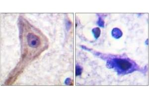 Immunohistochemistry analysis of paraffin-embedded human brain tissue, using Akt1 S1 (Ab-246) Antibody. (PRAS40 antibody  (AA 207-256))