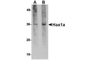 Image no. 1 for anti-HCLS1 Associated Protein X-1 (HAX1) (N-Term) antibody (ABIN341762) (HAX1 antibody  (N-Term))