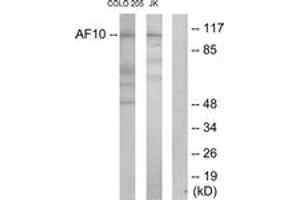 Western Blotting (WB) image for anti-Protein AF-10 (MLLT10) (AA 211-260) antibody (ABIN2889521) (MLLT10 antibody  (AA 211-260))