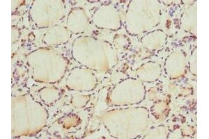 Immunohistochemistry of paraffin-embedded human thyroid tissue using ABIN7153399 at dilution of 1:100 (Cyclin E2 antibody  (AA 255-404))