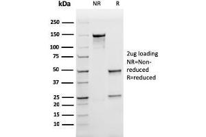 SDS-PAGE (SDS) image for anti-Ferritin, Light Polypeptide (FTL) (AA 38-165) antibody (ABIN6939462)